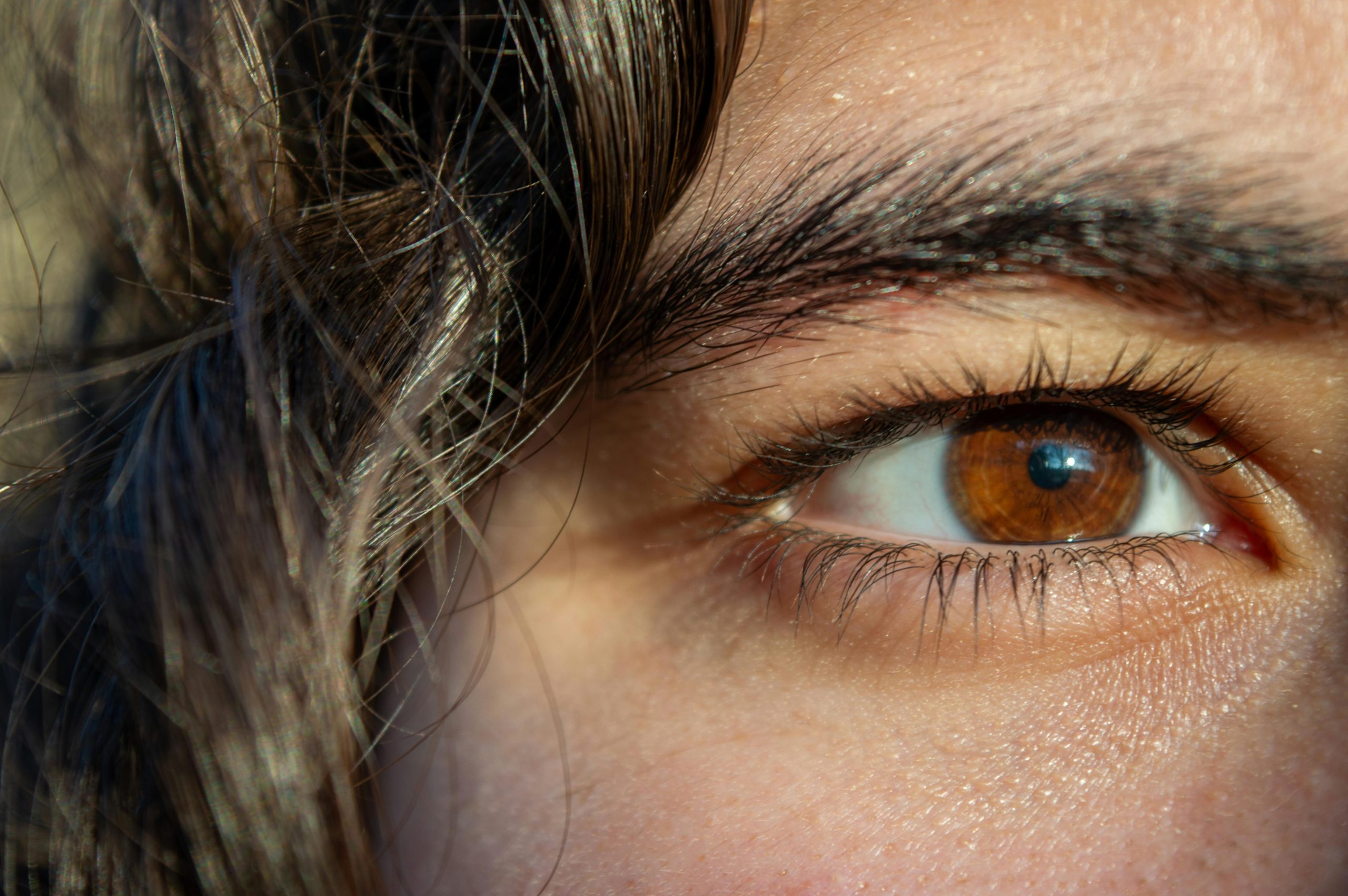 Ilustrasi brow lift